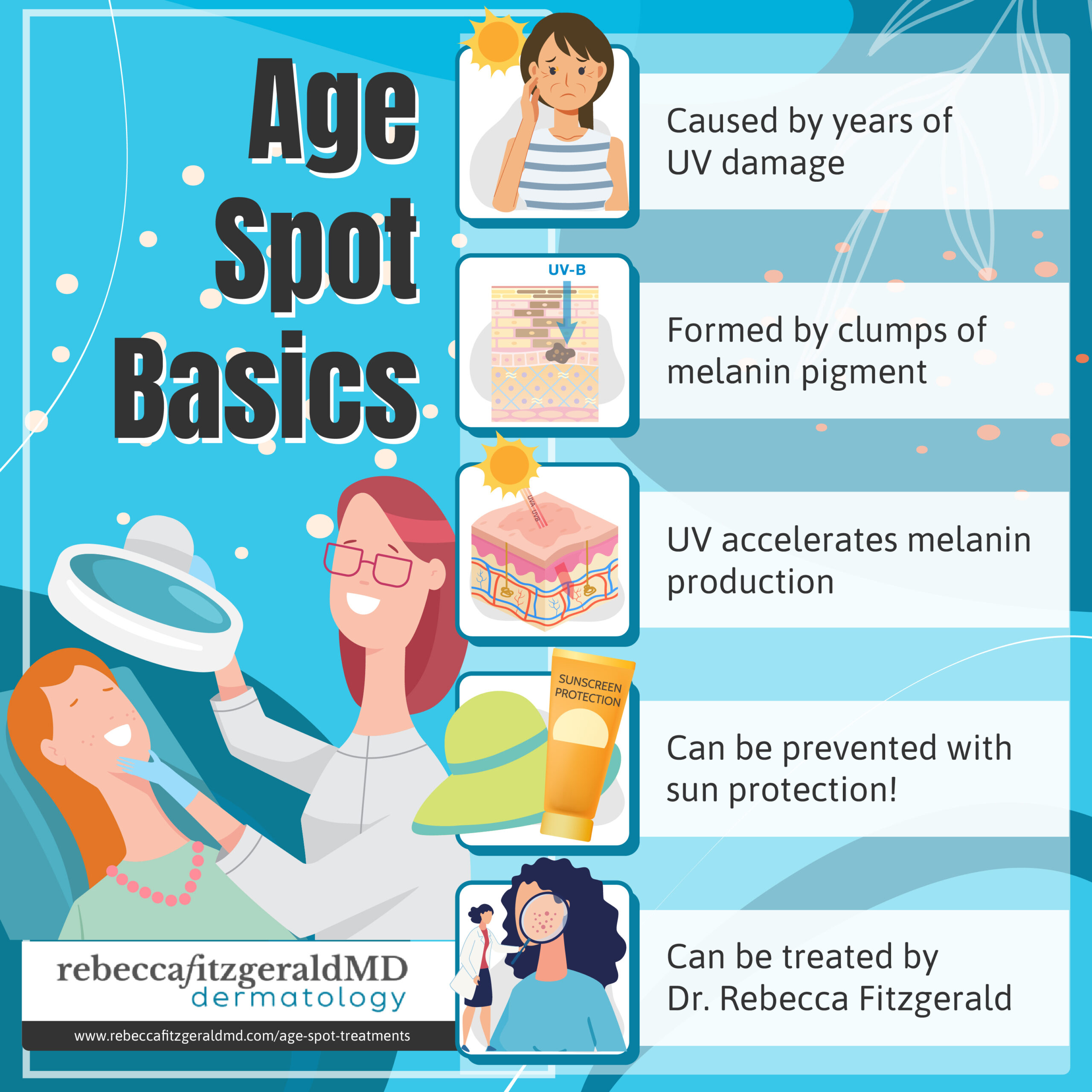 Age spots result of years of UVA exposure, formed by clumps of melanin pigment, accelerated melanin production, can be prevented with sunscreen, can be treated to reduce