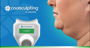 CoolSculpting applicator for under chin treatment next to man with excess fat under chin