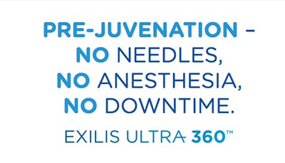 Exilis as prejuvenation treatment -no needles, no anesthesia, no downtime