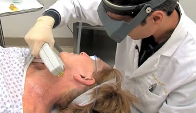 Woman having BBL photofacial on neck in doctor's office